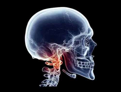 What does MRI/CBCT scan of the cervical spine show?